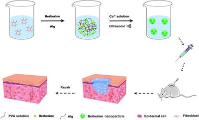 Recent advances of the nanocomposite hydrogel as a local drug delivery for diabetic ulcers